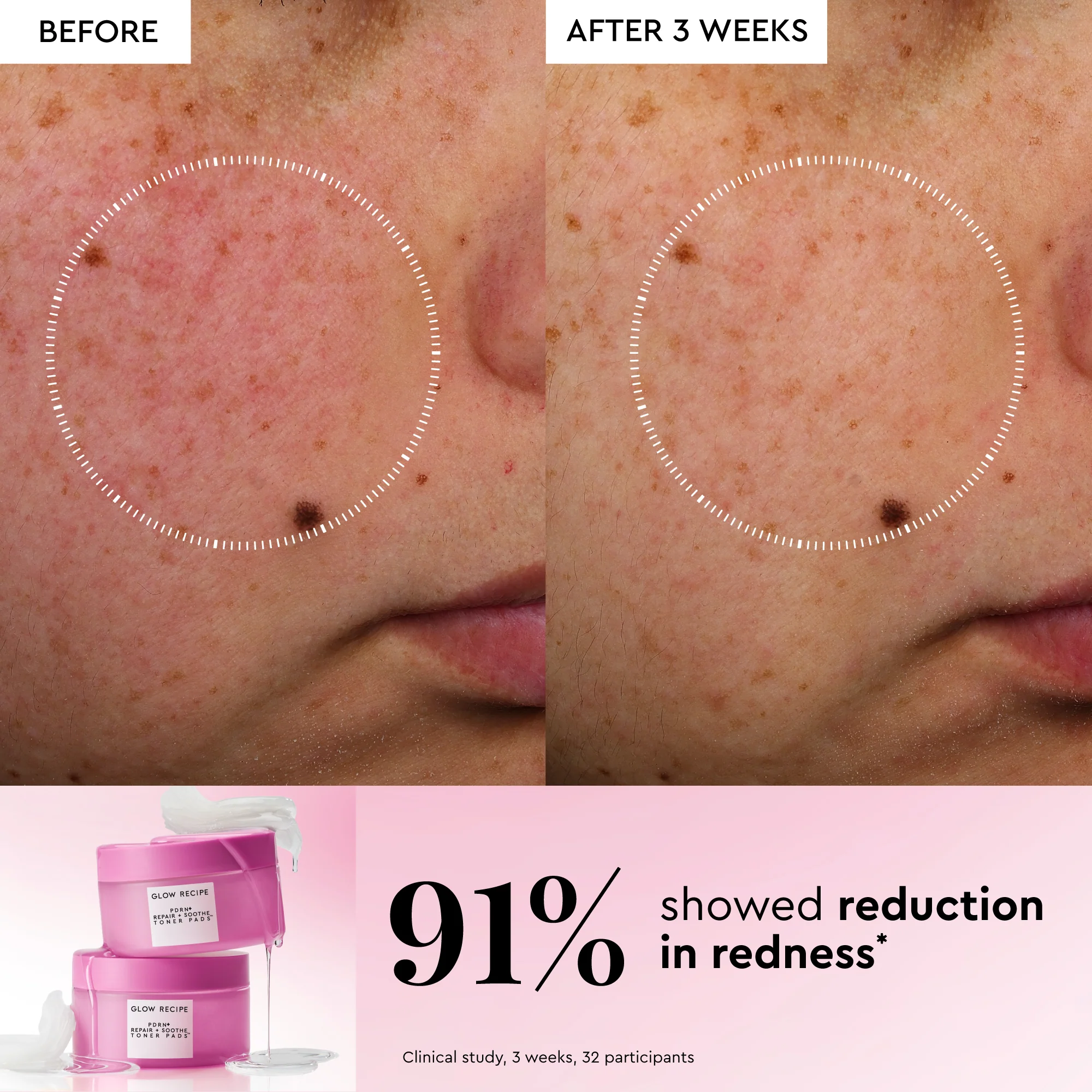 Korean Toner Pad Collection Trial Set - Image 6