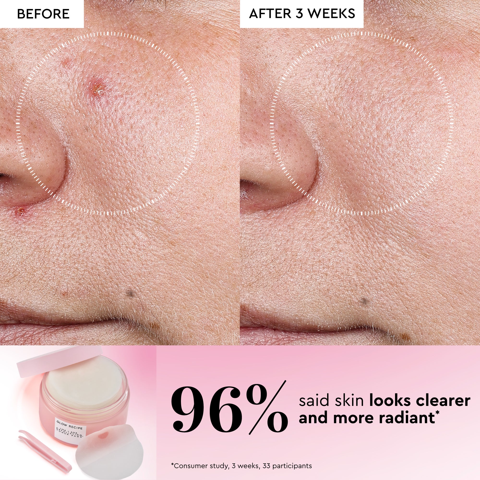 Korean Toner Pad Multi-Masking Kit - Image 3