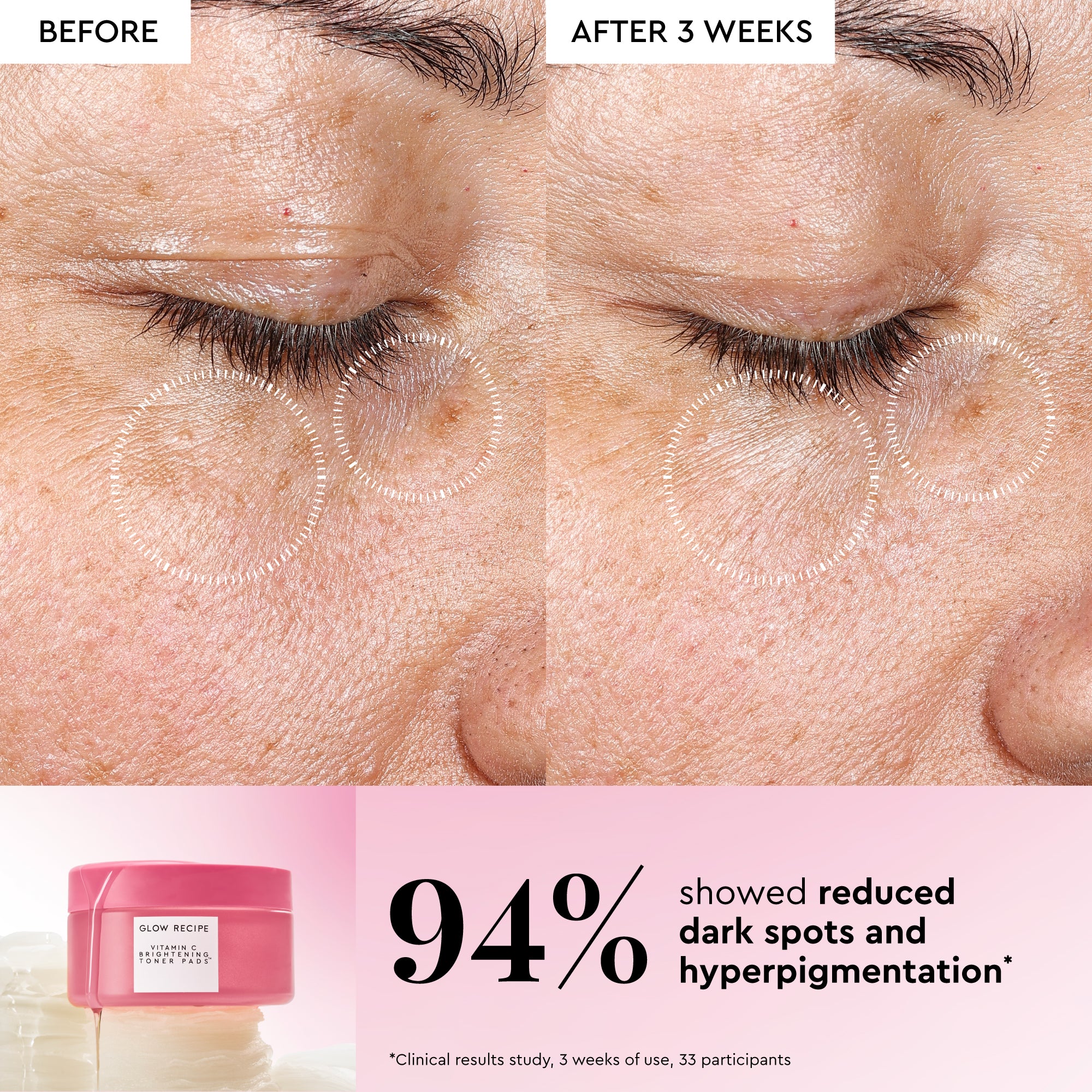 Vitamin C Brightening Korean Toner Pads - Image 3