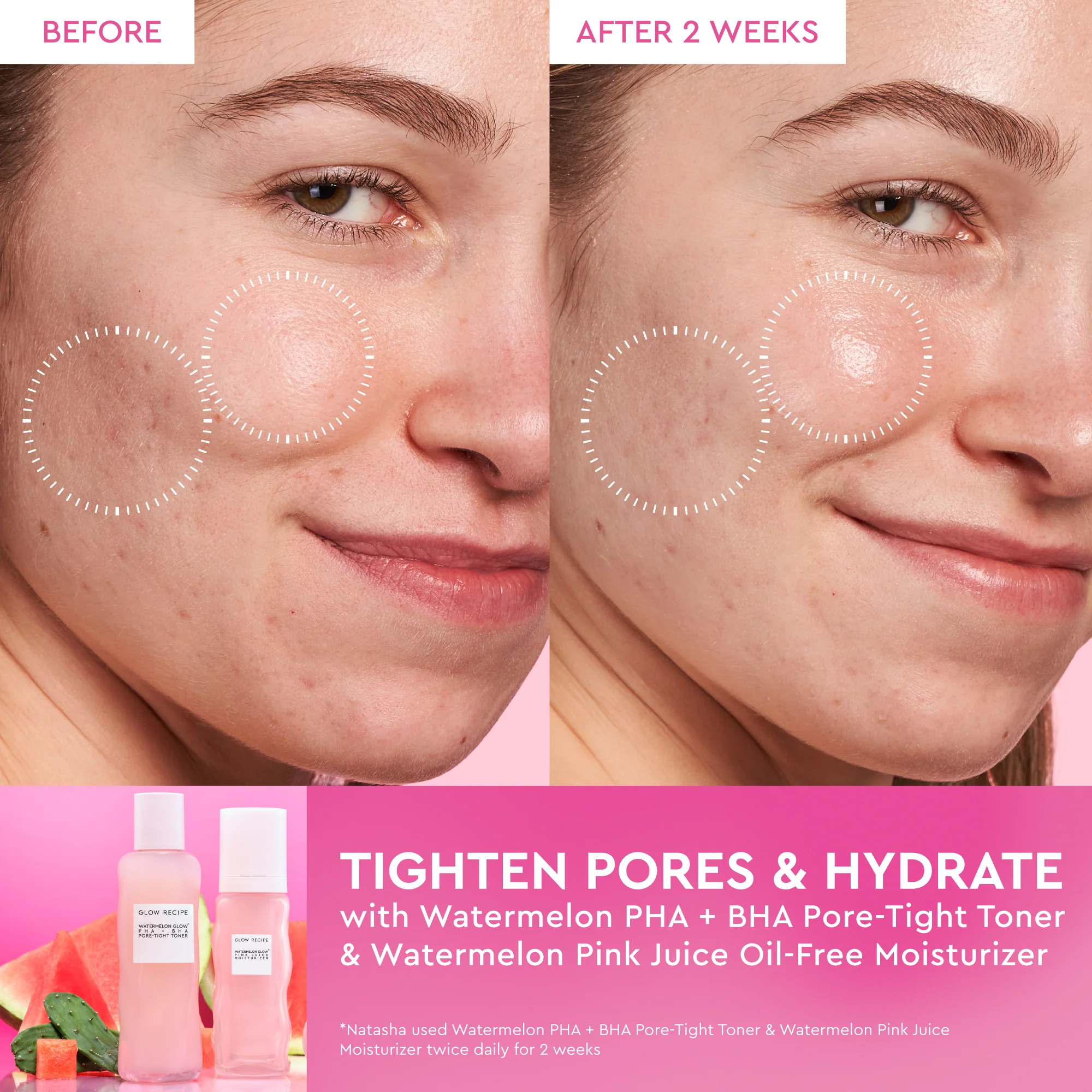 Watermelon Glow PHA+BHA Pore-Tight Toner - Image 5